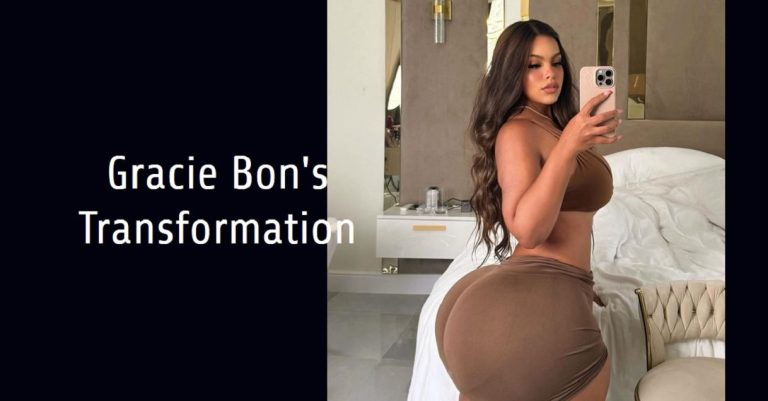 Gracie Bon, IG Model, Opens Up About Surgery: Before and After Photos Shared